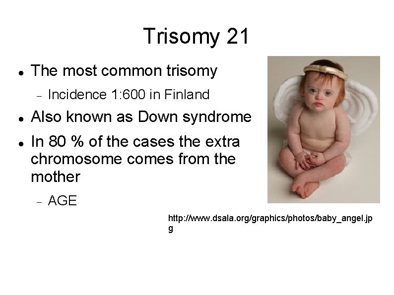 Trisomy 21 The most common trisomy Incidence 1: 600 in Finland Also known as