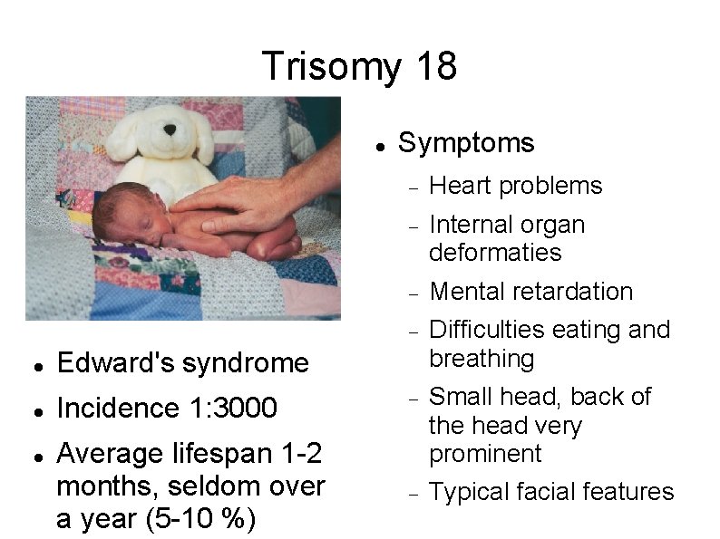 Trisomy 18 Symptoms Heart problems Internal organ deformaties Mental retardation Difficulties eating and breathing