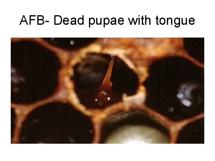 AFB- Dead pupae with tongue 