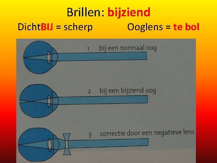 Brillen: bijziend Dicht. BIJ = scherp Ooglens = te bol 