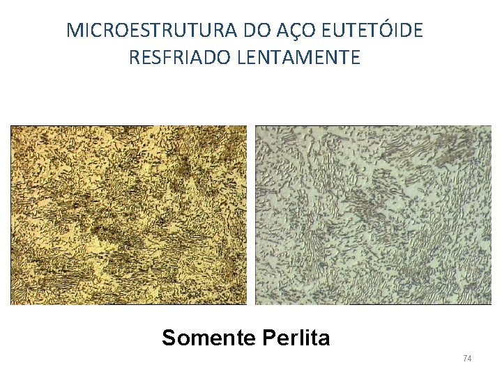 MICROESTRUTURA DO AÇO EUTETÓIDE RESFRIADO LENTAMENTE Somente Perlita 74 