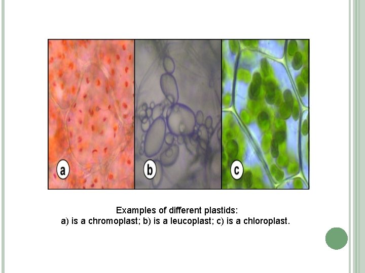 Examples of different plastids: a) is a chromoplast; b) is a leucoplast; c) is