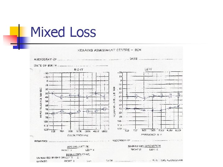 Mixed Loss 