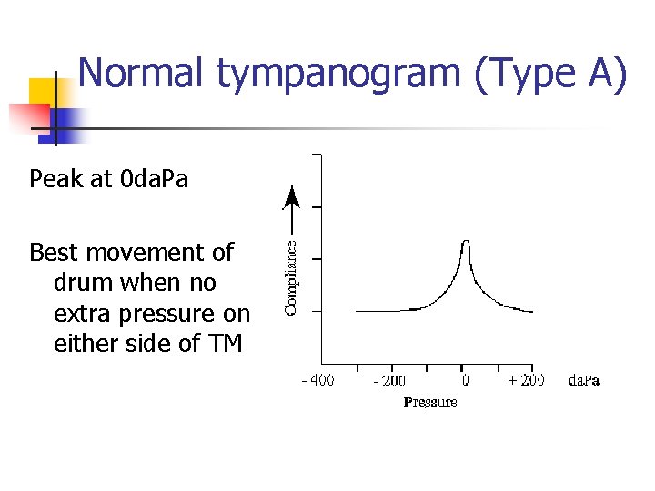Normal tympanogram (Type A) Peak at 0 da. Pa Best movement of drum when