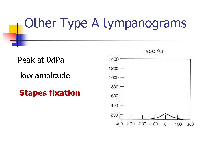 Other Type A tympanograms Peak at 0 d. Pa low amplitude Stapes fixation 