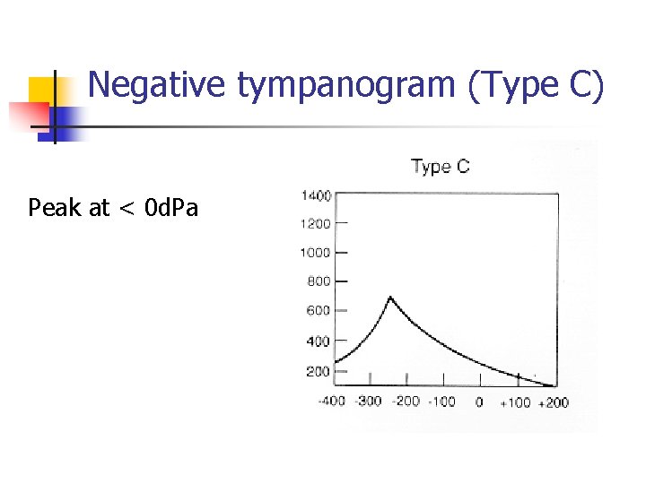 Negative tympanogram (Type C) Peak at < 0 d. Pa 
