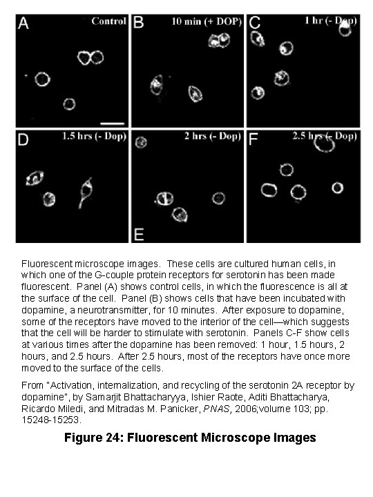 Fluorescent microscope images. These cells are cultured human cells, in which one of the