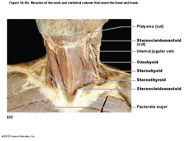 Figure 10. 10 c Muscles of the neck and vertebral column that move the