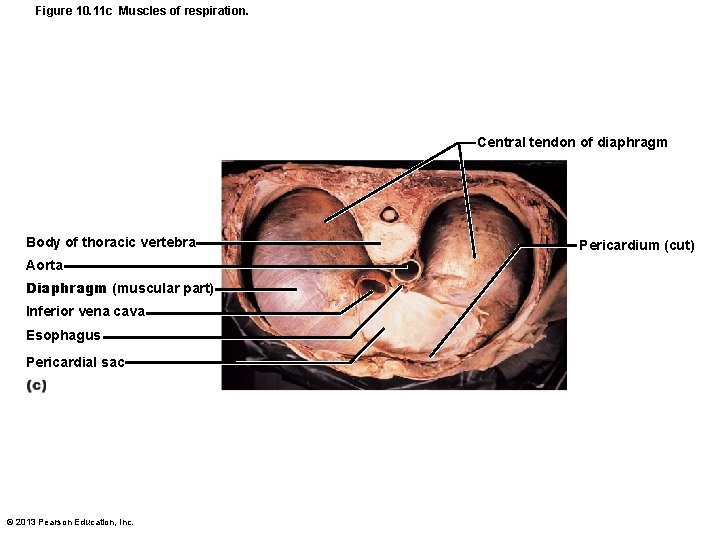 Figure 10. 11 c Muscles of respiration. Central tendon of diaphragm Body of thoracic