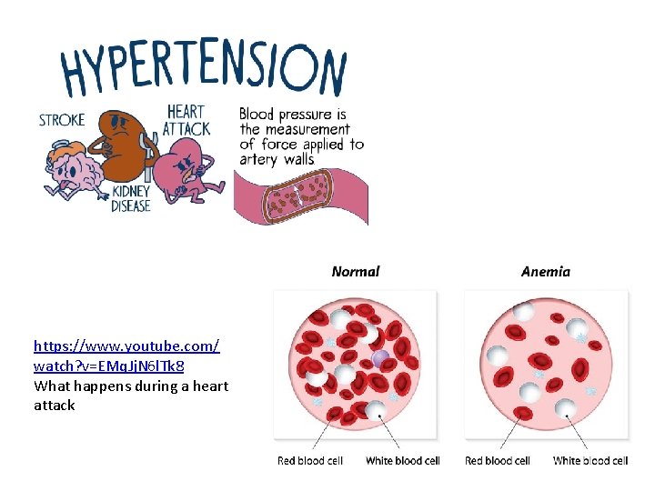 https: //www. youtube. com/ watch? v=EMq. Jj. N 6 l. Tk 8 What happens