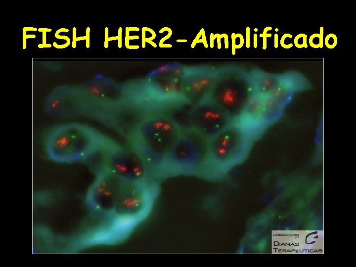 FISH HER 2 -Amplificado 
