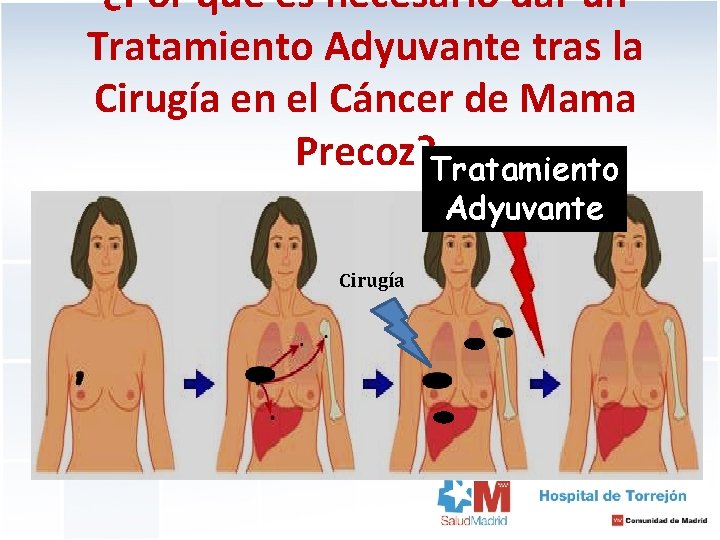 ¿Por qué es necesario dar un Tratamiento Adyuvante tras la Cirugía en el Cáncer