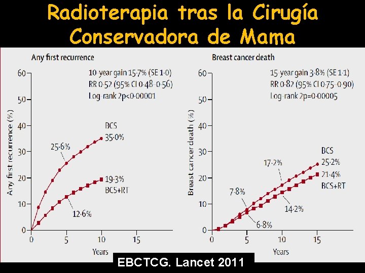 Radioterapia tras la Cirugía Conservadora de Mama EBCTCG. Lancet 2011 