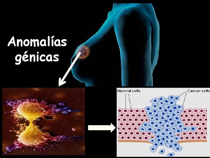 Anomalías génicas 