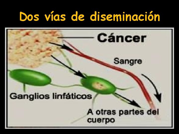 Dos vías de diseminación 