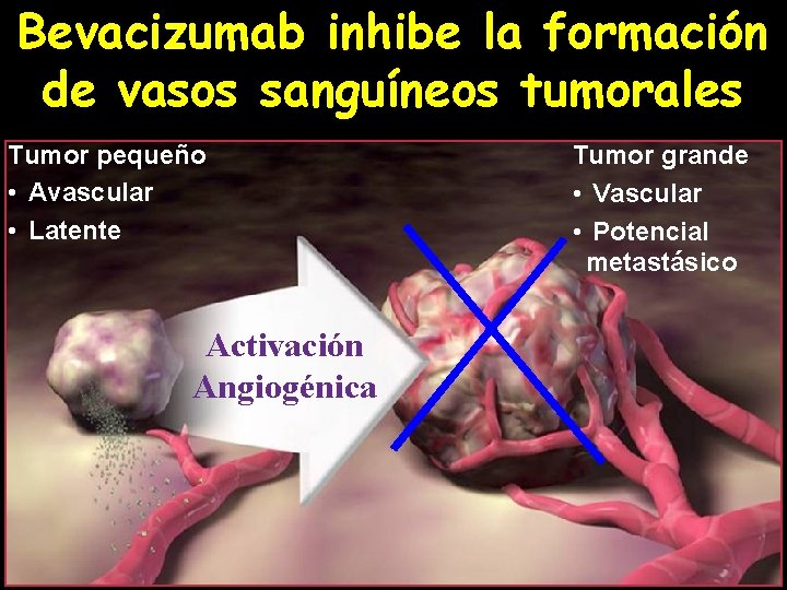 Bevacizumab inhibe la formación de vasos sanguíneos tumorales Tumor pequeño • Avascular • Latente