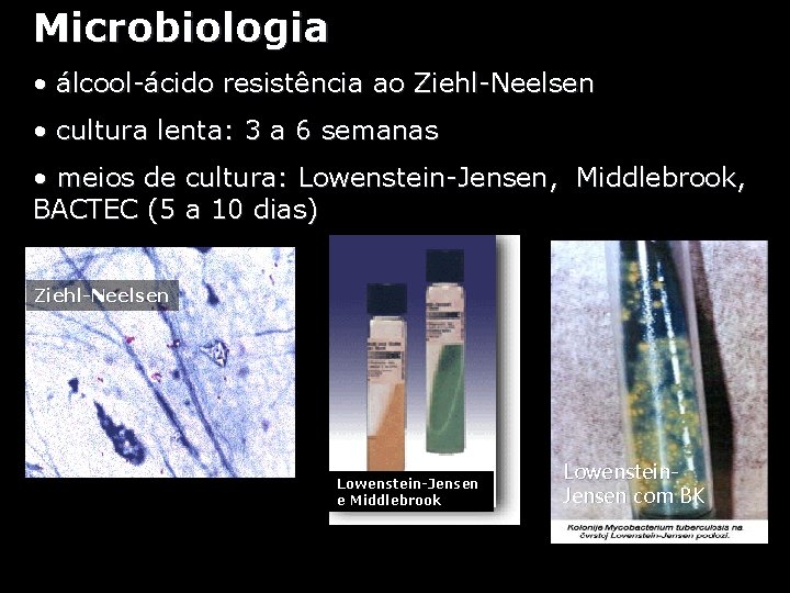Microbiologia • álcool-ácido resistência ao Ziehl-Neelsen • cultura lenta: 3 a 6 semanas •