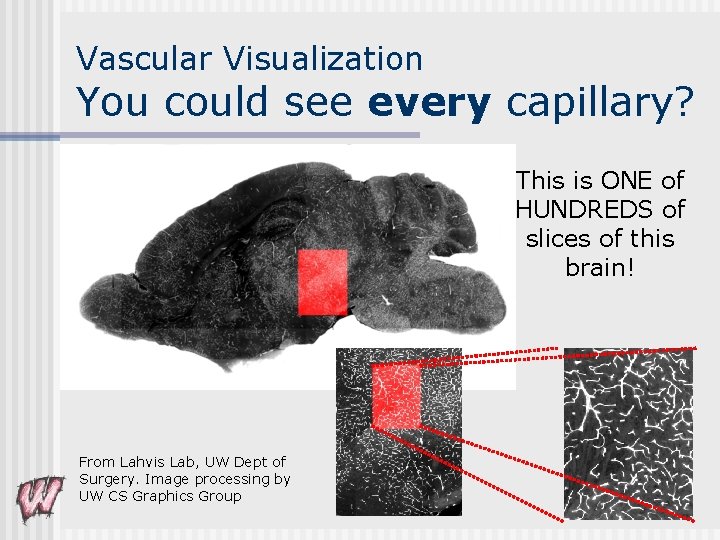 Vascular Visualization You could see every capillary? This is ONE of HUNDREDS of slices