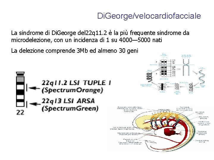 Di. George/velocardiofacciale La sindrome di Di. George del 22 q 11. 2 è la