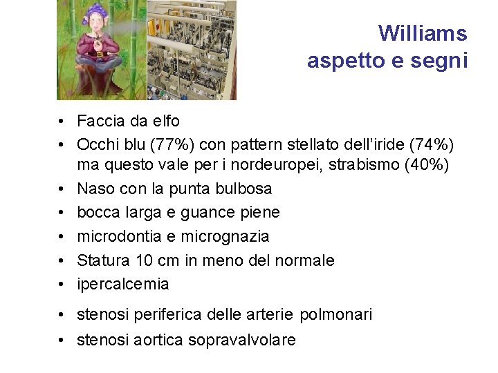 Williams aspetto e segni • Faccia da elfo • Occhi blu (77%) con pattern