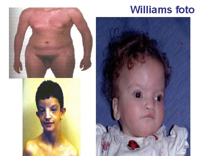 Williams foto 