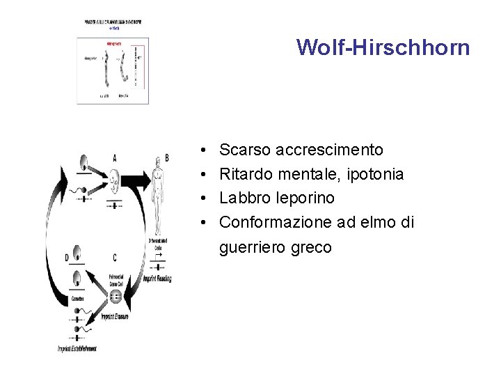 Wolf-Hirschhorn • • Scarso accrescimento Ritardo mentale, ipotonia Labbro leporino Conformazione ad elmo di