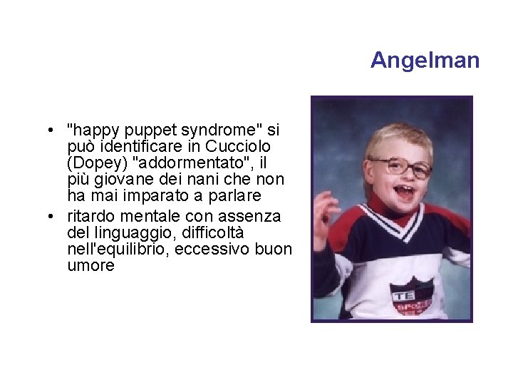 Angelman • "happy puppet syndrome" si può identificare in Cucciolo (Dopey) "addormentato", il più