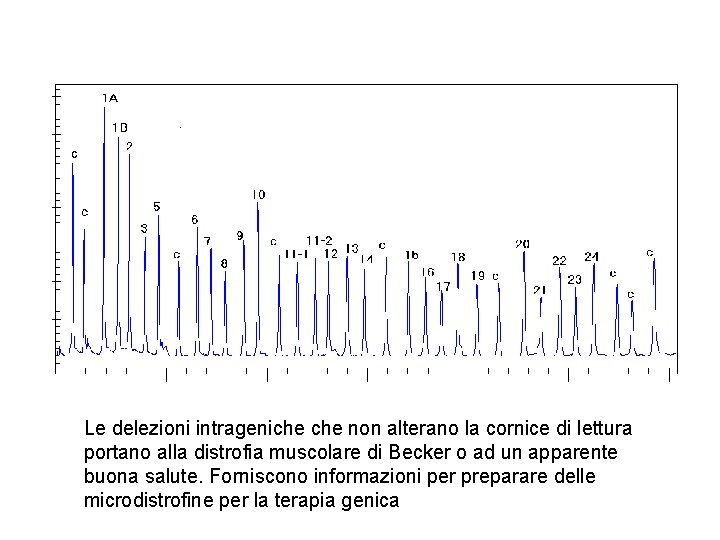 Le delezioni intrageniche non alterano la cornice di lettura portano alla distrofia muscolare di