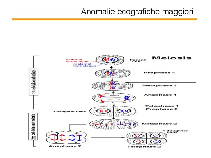 Anomalie ecografiche maggiori 