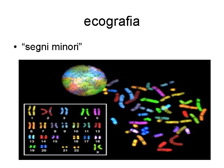 ecografia • “segni minori” 