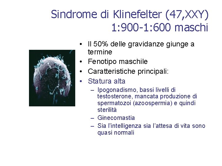 Sindrome di Klinefelter (47, XXY) 1: 900 -1: 600 maschi • Il 50% delle