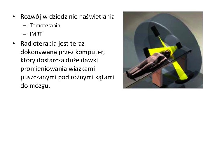  • Rozwój w dziedzinie naświetlania – Tomoterapia – IMRT • Radioterapia jest teraz