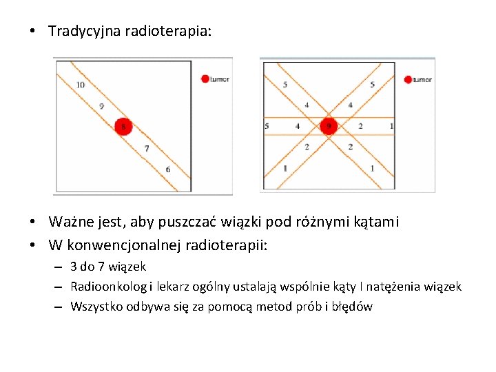  • Tradycyjna radioterapia: • Ważne jest, aby puszczać wiązki pod różnymi kątami •