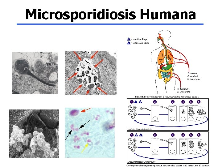 Microsporidiosis Humana 