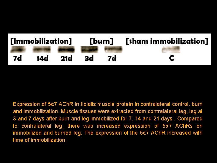 Expression of 5α 7 ACh. R in tibialis muscle protein in contralateral control, burn