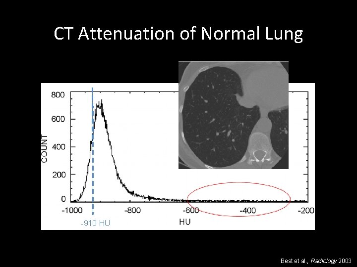 CT Attenuation of Normal Lung -910 HU Best et al. , Radiology 2003 