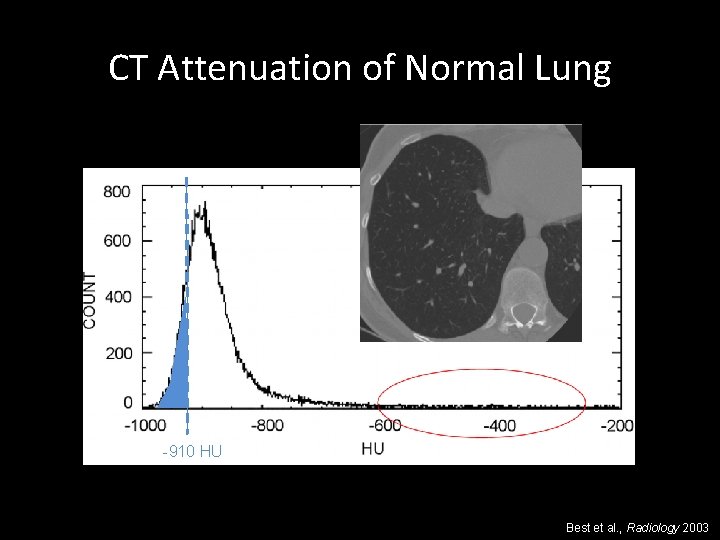 CT Attenuation of Normal Lung -910 HU Best et al. , Radiology 2003 