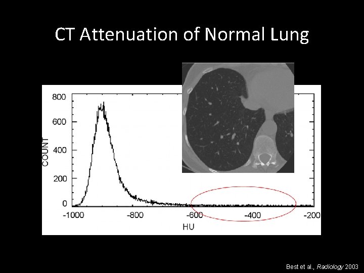 CT Attenuation of Normal Lung Best et al. , Radiology 2003 