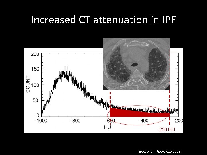 Increased CT attenuation in IPF -250 HU Best et al. , Radiology 2003 