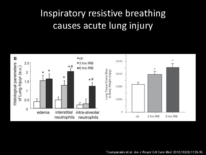 Inspiratory resistive breathing causes acute lung injury Toumpanakis et al. Am J Respir Crit