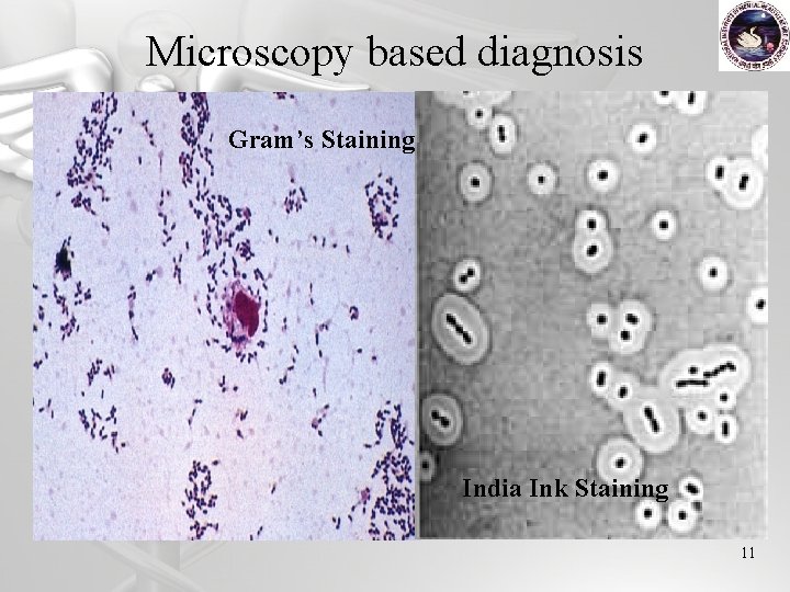 Microscopy based diagnosis Gram’s Staining India Ink Staining 11 