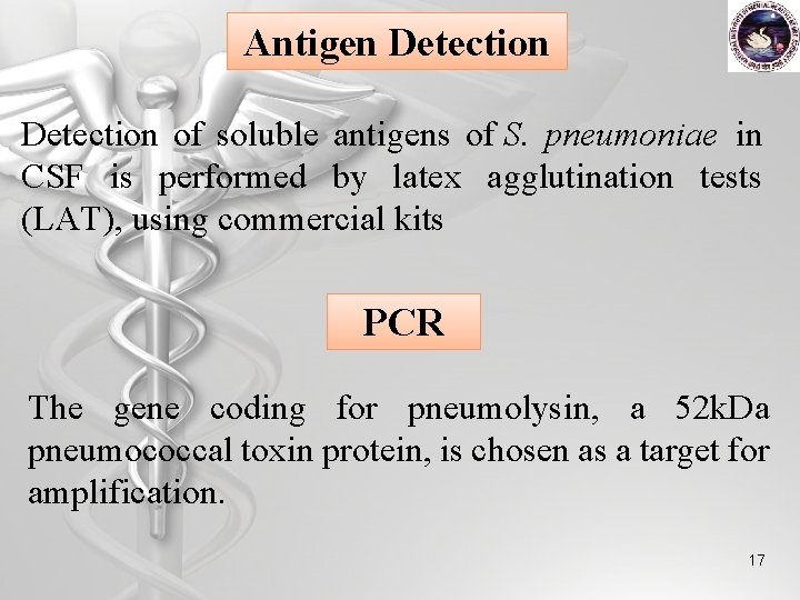 Antigen Detection of soluble antigens of S. pneumoniae in CSF is performed by latex