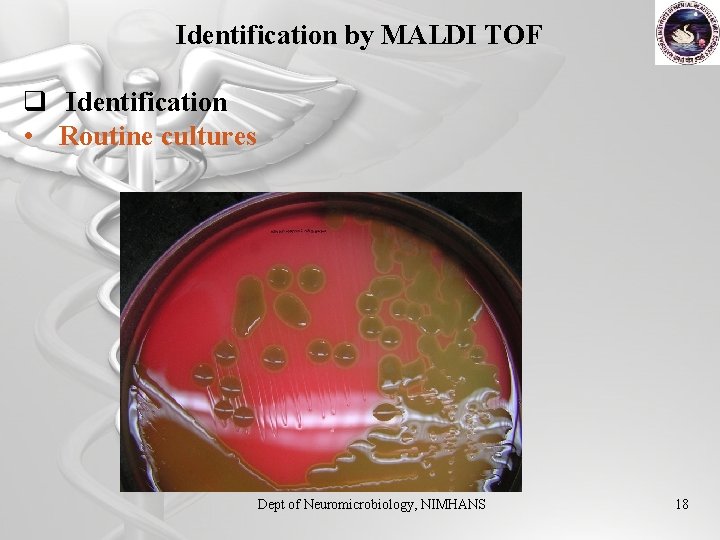 Identification by MALDI TOF q Identification • Routine cultures Dept of Neuromicrobiology, NIMHANS 18