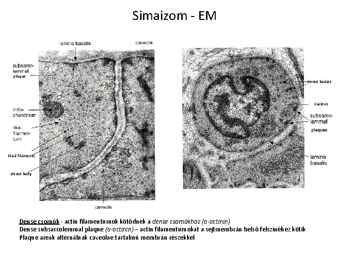 Simaizom - EM plaque dense bodies nucleus thin thick filaments dense body Dense csomók