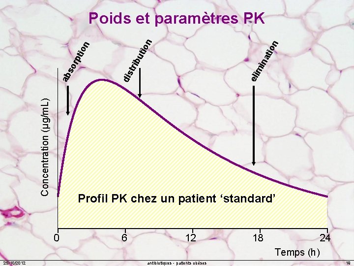 Concentration (µg/m. L) n tio mi na bu tri eli Profil PK chez un