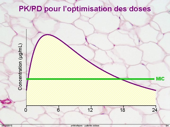 Concentration (µg/m. L) PK/PD pour l’optimisation des doses MIC 0 25/10/2012 6 12 antibiotiques
