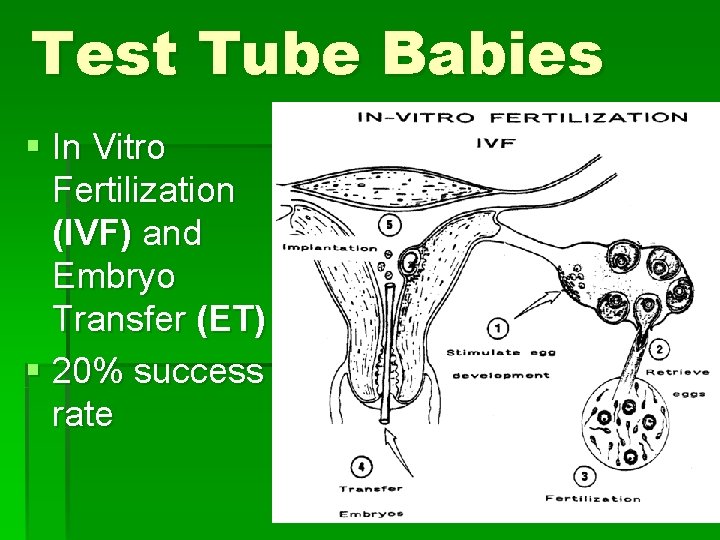 Test Tube Babies § In Vitro Fertilization (IVF) and Embryo Transfer (ET) § 20%