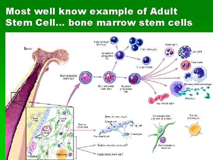 Most well know example of Adult Stem Cell… bone marrow stem cells 