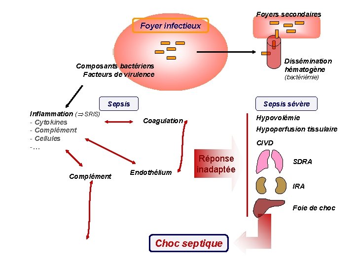 Foyers secondaires Foyer infectieux Dissémination hématogène Composants bactériens Facteurs de virulence (bactériémie) Sepsis Inflammation