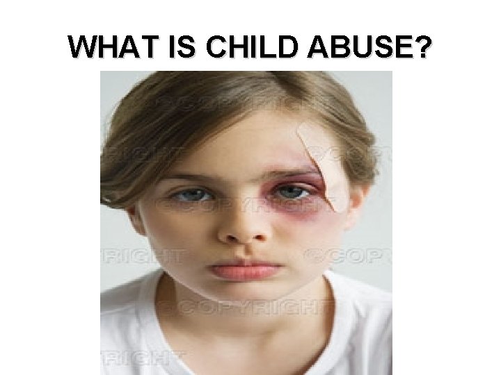 WHAT IS CHILD ABUSE? 